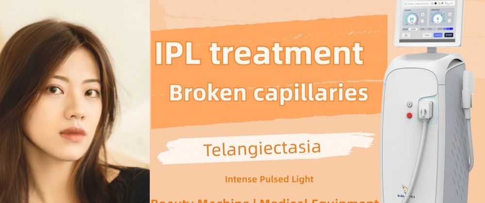 Cover image for IPL treatment for broken capillaries, how to set the treatment parameters for better results?